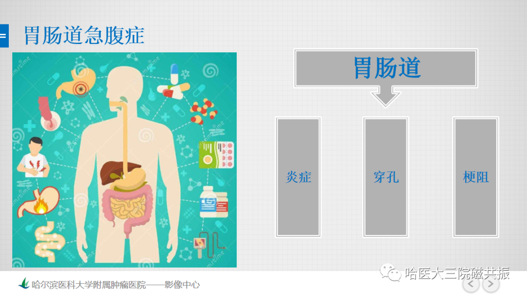 影像PPT - 【PPT】急腹症影像学诊断-30