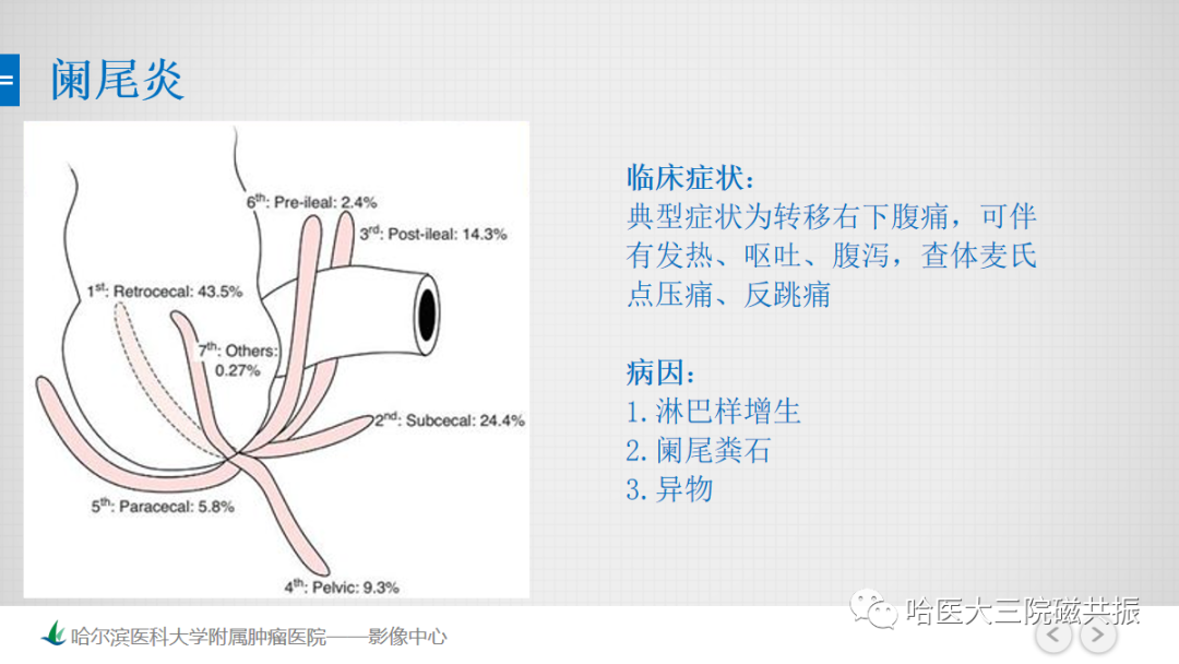 影像PPT - 【PPT】急腹症影像学诊断-31