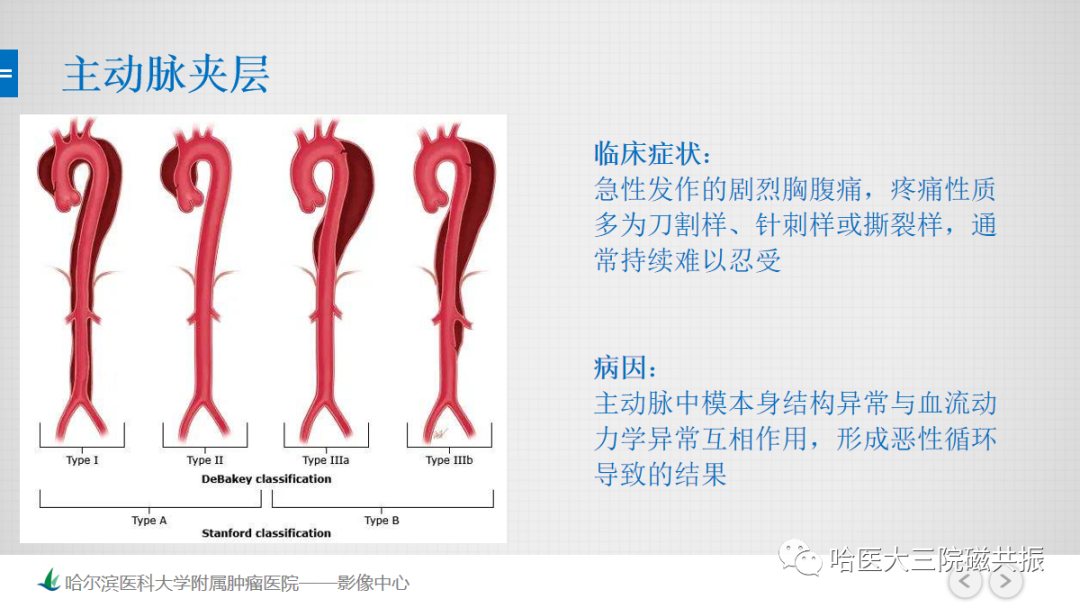 影像PPT - 【PPT】急腹症影像学诊断-55