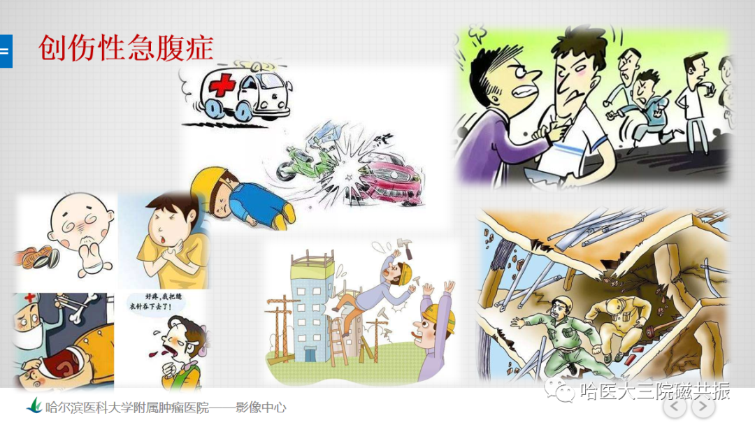 影像PPT - 【PPT】急腹症影像学诊断-66
