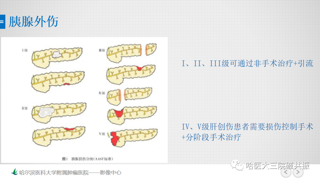 影像PPT - 【PPT】急腹症影像学诊断-70