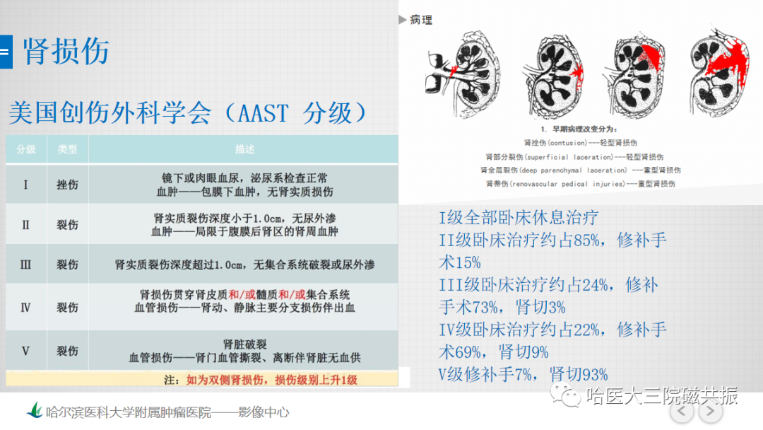影像PPT - 【PPT】急腹症影像学诊断-77