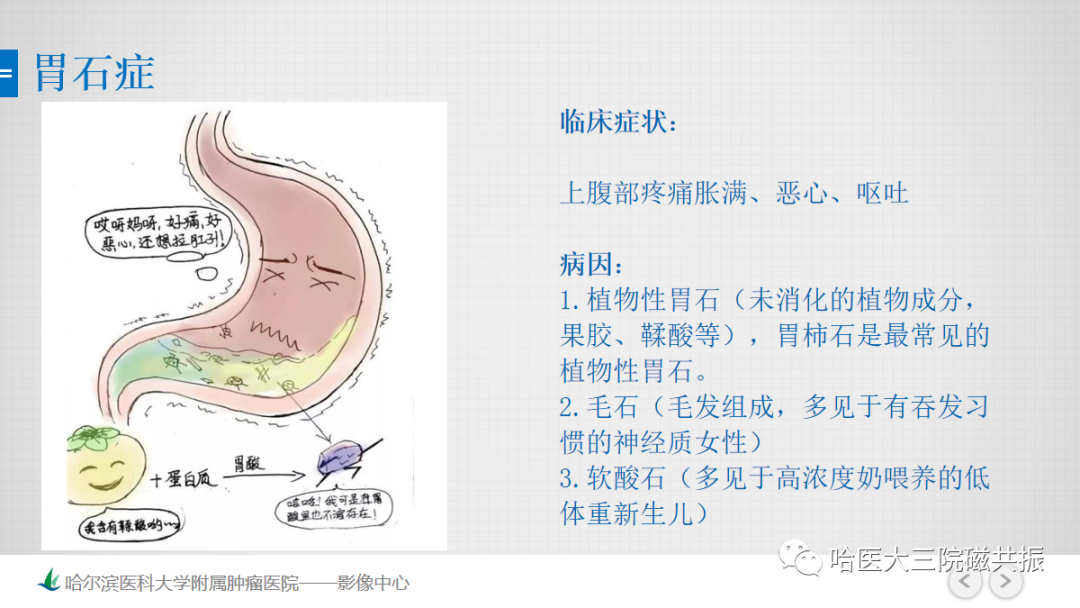 影像PPT - 【PPT】急腹症影像学诊断-83