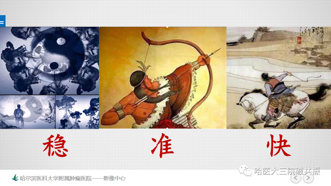 影像PPT - 【PPT】急腹症影像学诊断-88