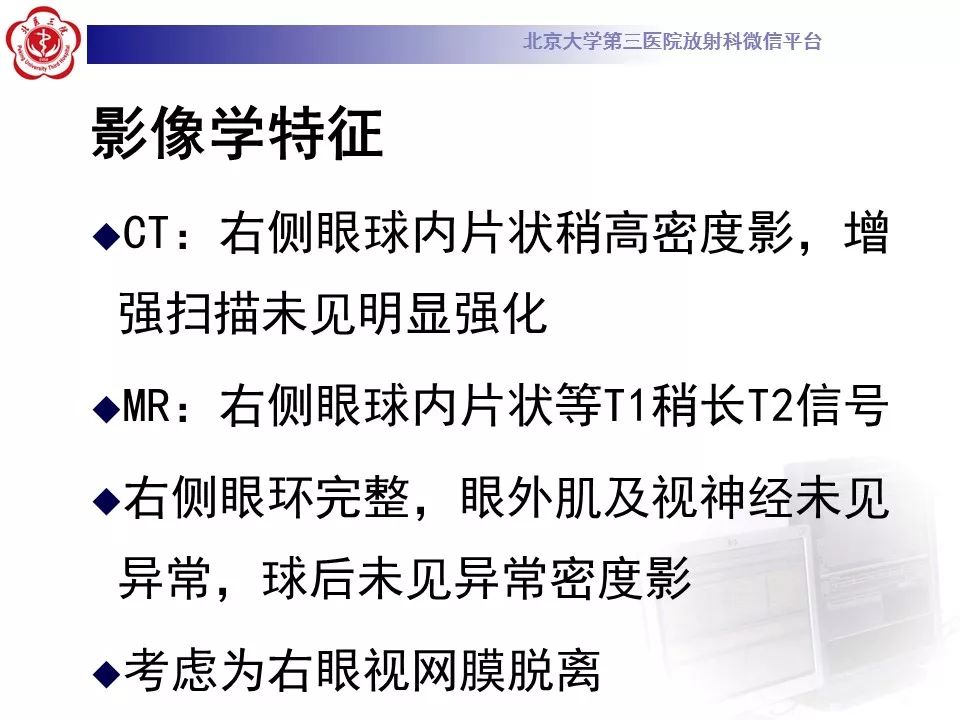 影像PPT - 【PPT】Coats病影像-7