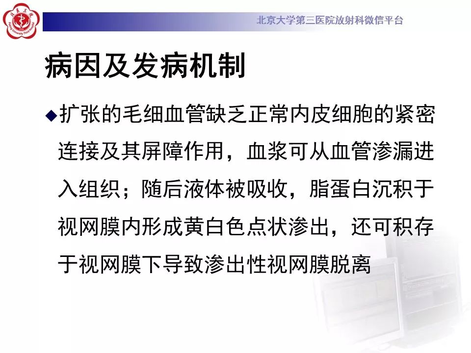 影像PPT - 【PPT】Coats病影像-12