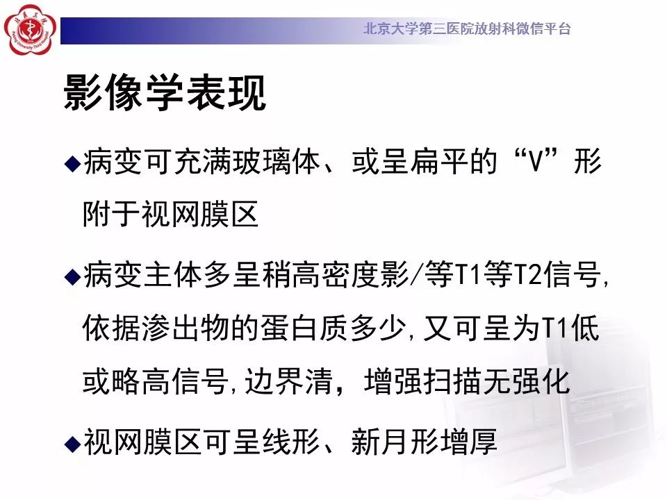 影像PPT - 【PPT】Coats病影像-17