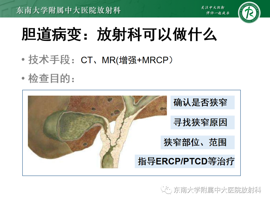 影像PPT - 【病例】胆管狭窄3例X线CT及MR病例随访-18 影像PPT - 【病例】胆管狭窄3例X线CT及MR病例随访-18