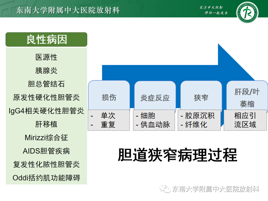 影像PPT - 【病例】胆管狭窄3例X线CT及MR病例随访-20 影像PPT - 【病例】胆管狭窄3例X线CT及MR病例随访-20