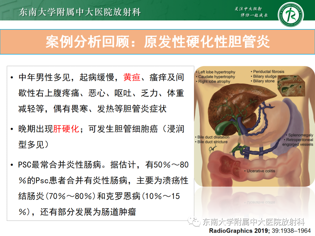 影像PPT - 【病例】胆管狭窄3例X线CT及MR病例随访-23 影像PPT - 【病例】胆管狭窄3例X线CT及MR病例随访-23