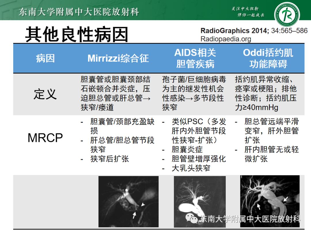 影像PPT - 【病例】胆管狭窄3例X线CT及MR病例随访-37 影像PPT - 【病例】胆管狭窄3例X线CT及MR病例随访-37