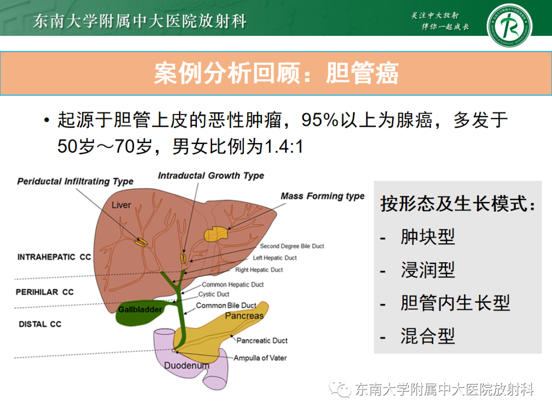 影像PPT - 【病例】胆管狭窄3例X线CT及MR病例随访-39 影像PPT - 【病例】胆管狭窄3例X线CT及MR病例随访-39