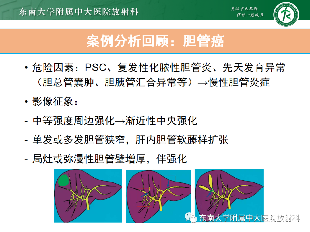 影像PPT - 【病例】胆管狭窄3例X线CT及MR病例随访-40 影像PPT - 【病例】胆管狭窄3例X线CT及MR病例随访-40