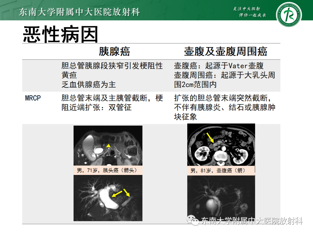 影像PPT - 【病例】胆管狭窄3例X线CT及MR病例随访-42 影像PPT - 【病例】胆管狭窄3例X线CT及MR病例随访-42