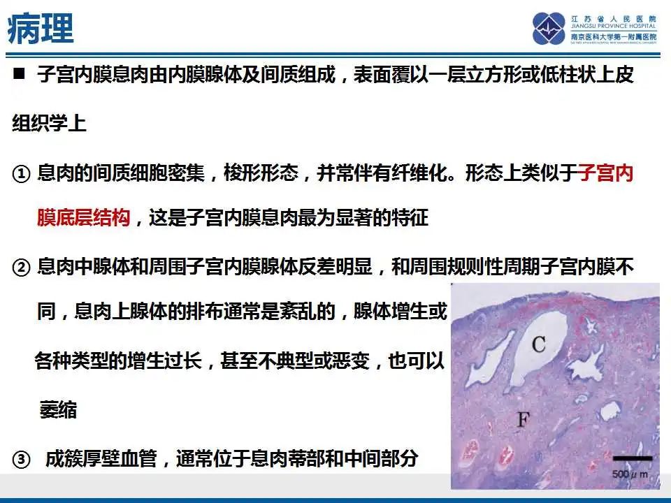 影像PPT - 【PPT】子宫内膜息肉-17