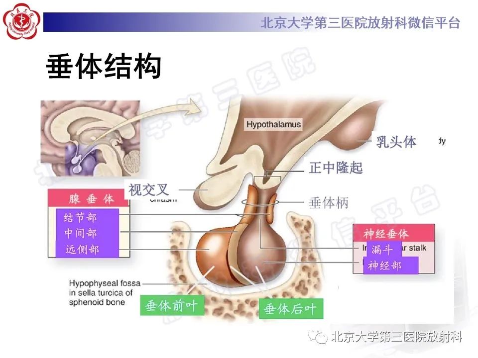 影像PPT - 【PPT】垂体病变的MRI诊断思路-3