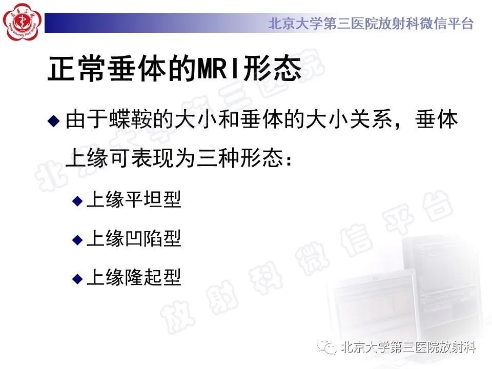影像PPT - 【PPT】垂体病变的MRI诊断思路-6