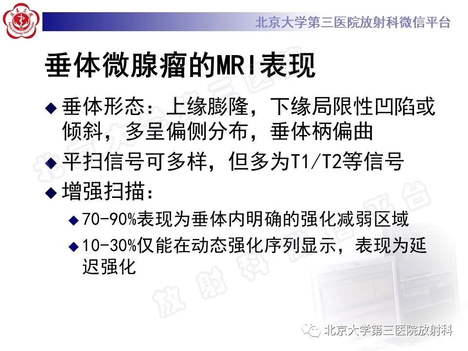 影像PPT - 【PPT】垂体病变的MRI诊断思路-20