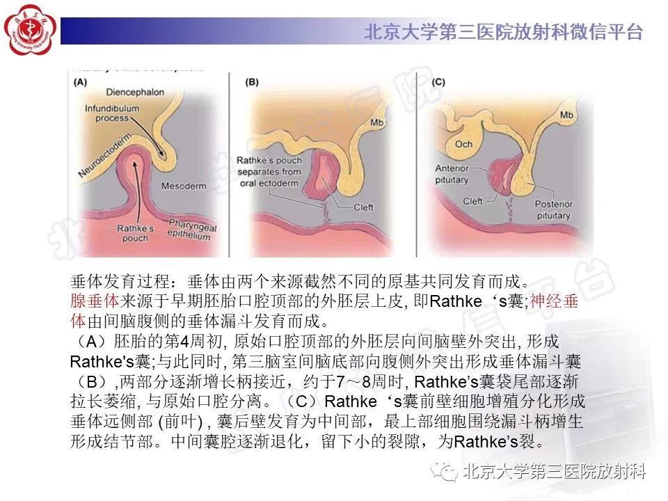 影像PPT - 【PPT】垂体病变的MRI诊断思路-32