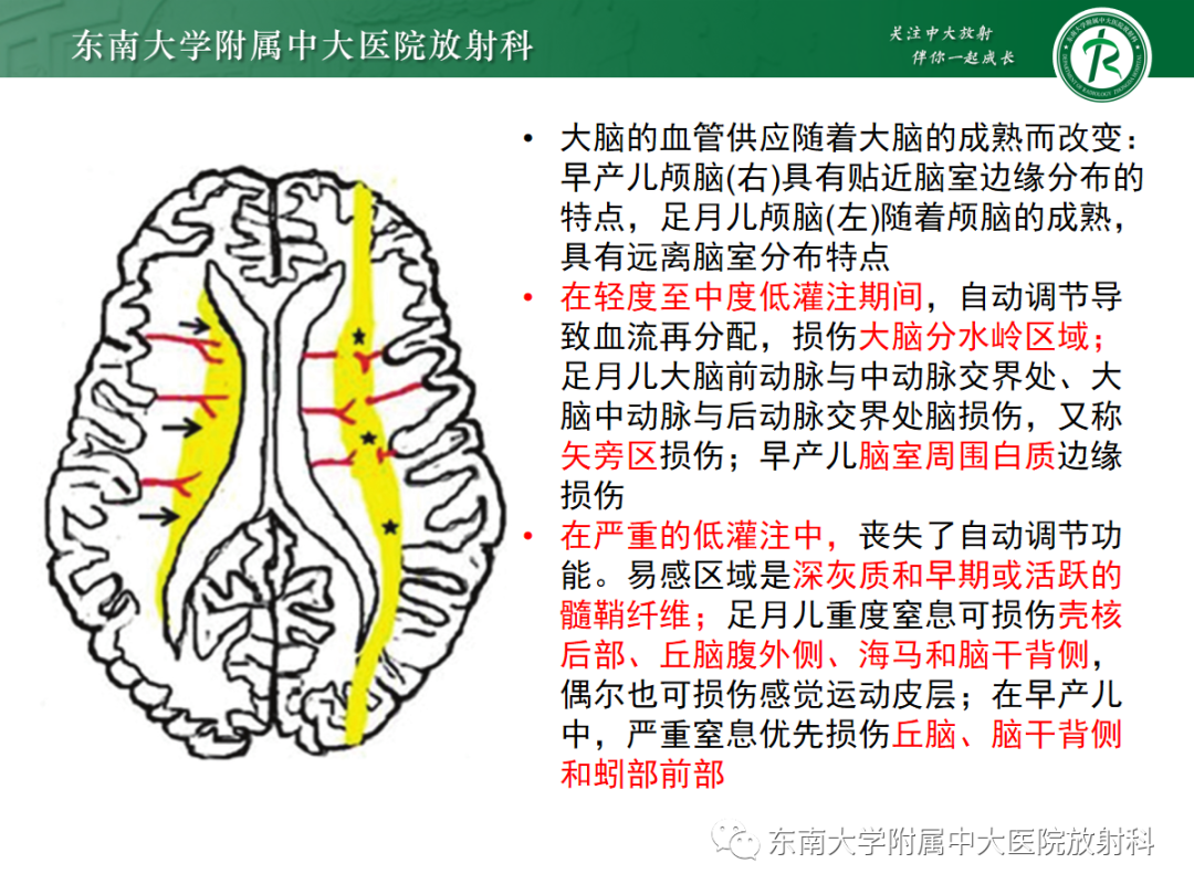 影像PPT - 【PPT】新生儿缺氧缺血性脑病-13