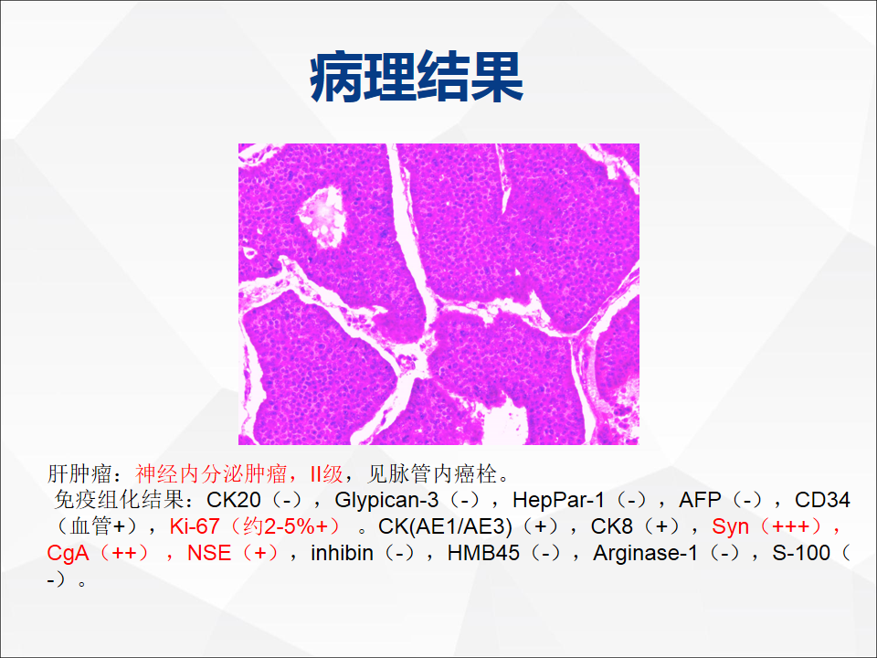 影像PPT - 【病例】肝脏神经内分泌肿瘤1例CT及MR-18