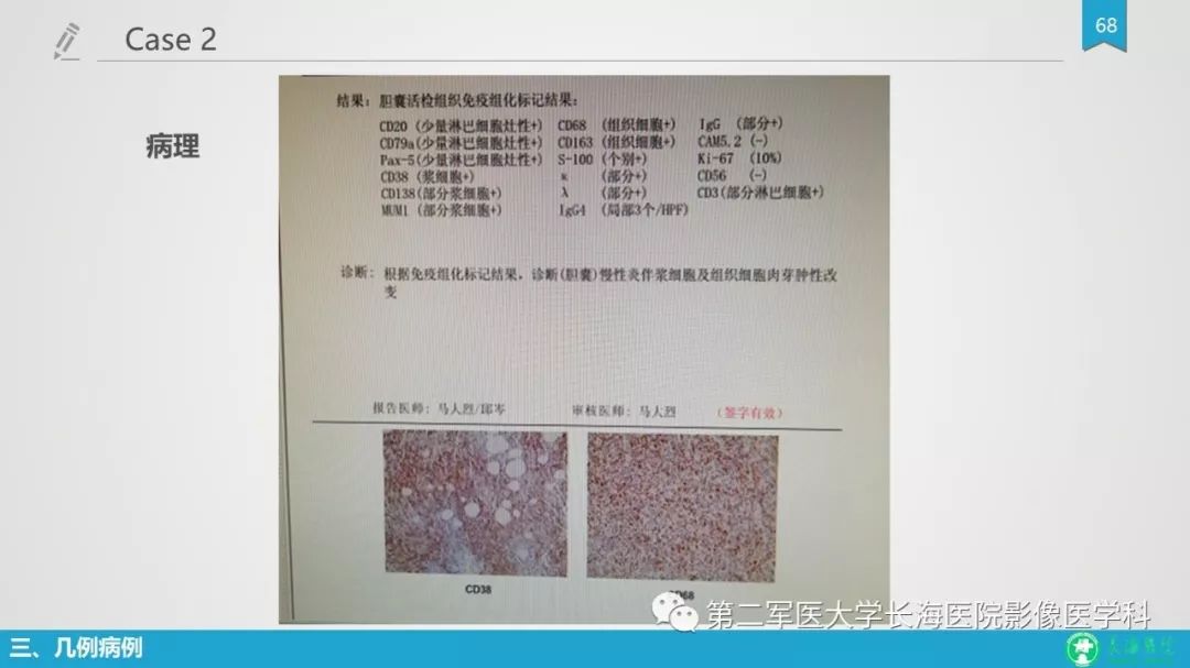 影像PPT - 【PPT】胆囊良性病变及其影像学特征-67