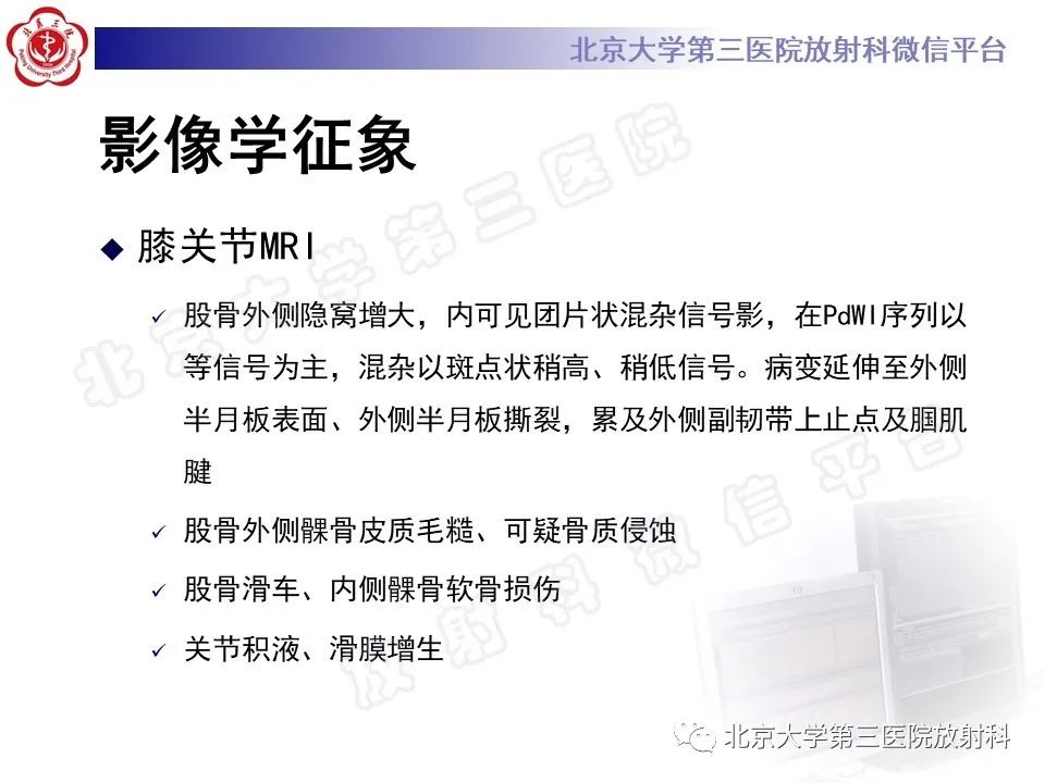 影像PPT - 【PPT】痛风-10