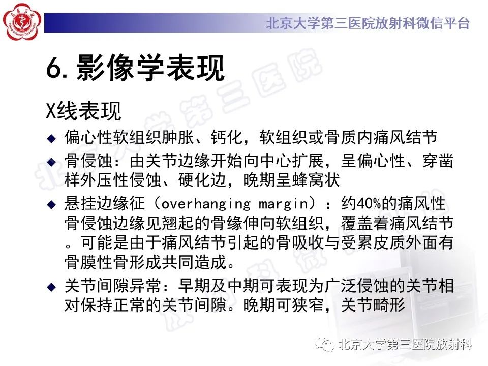 影像PPT - 【PPT】痛风-23
