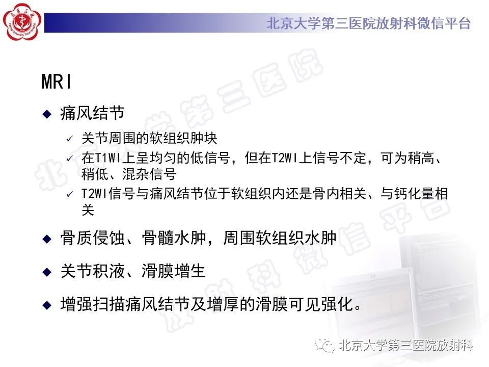 影像PPT - 【PPT】痛风-26