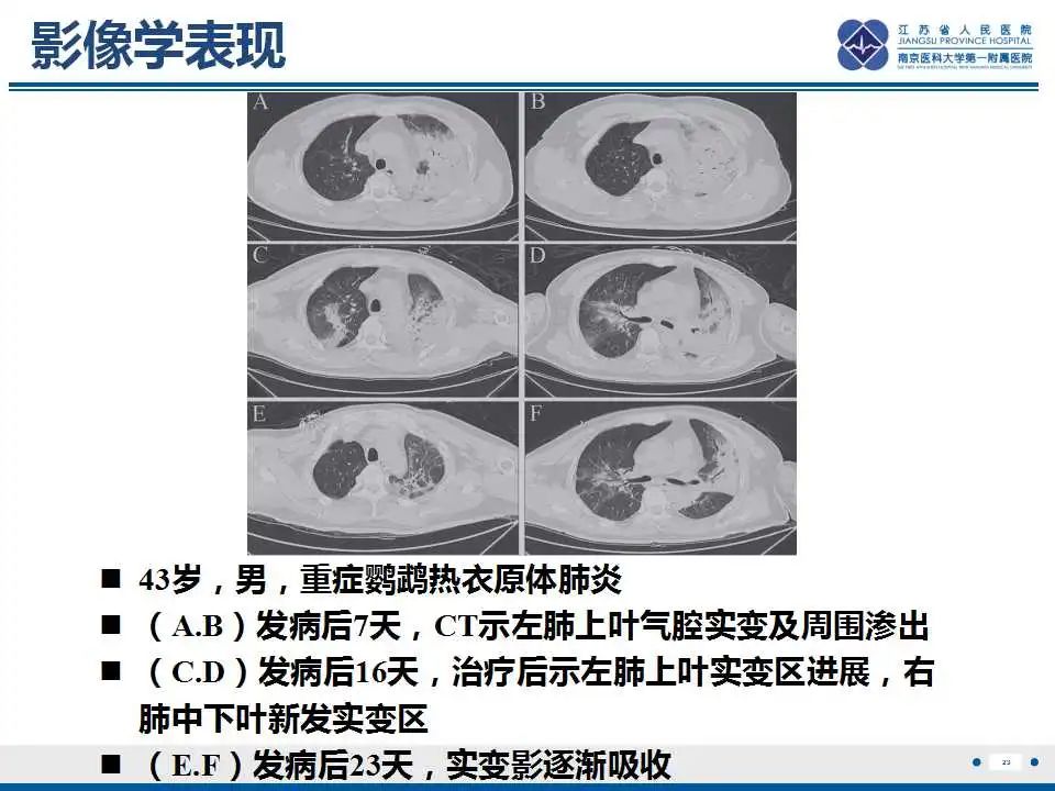 影像PPT - 【PPT】鹦鹉热衣原体肺炎-24