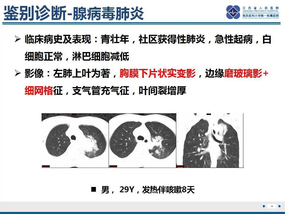 影像PPT - 【PPT】鹦鹉热衣原体肺炎-29
