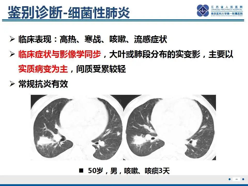 影像PPT - 【PPT】鹦鹉热衣原体肺炎-30