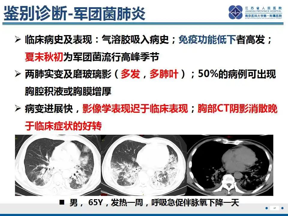 影像PPT - 【PPT】鹦鹉热衣原体肺炎-28