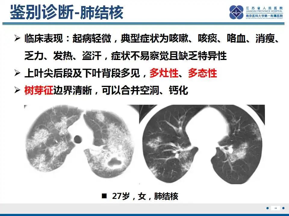 影像PPT - 【PPT】鹦鹉热衣原体肺炎-31