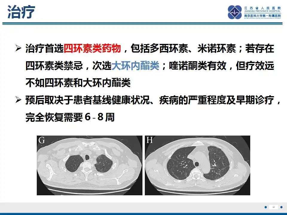 影像PPT - 【PPT】鹦鹉热衣原体肺炎-32