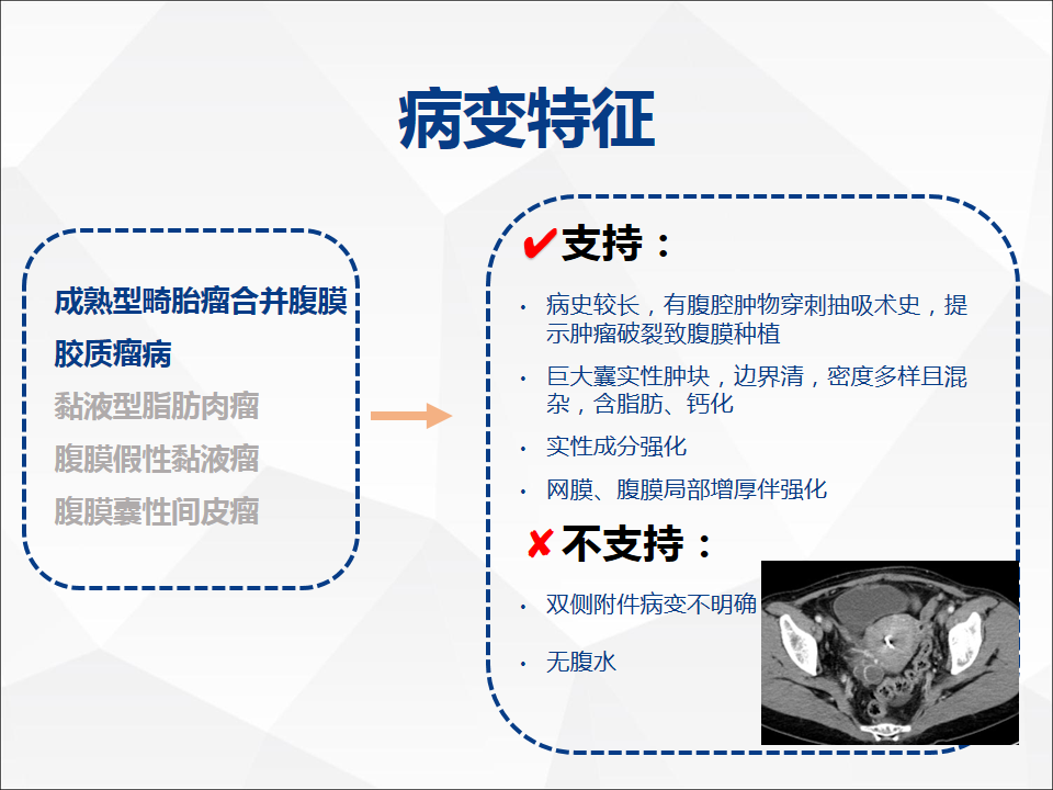 影像PPT - 【病例】腹腔成熟型畸胎瘤合并腹膜胶质瘤病1例CT-14