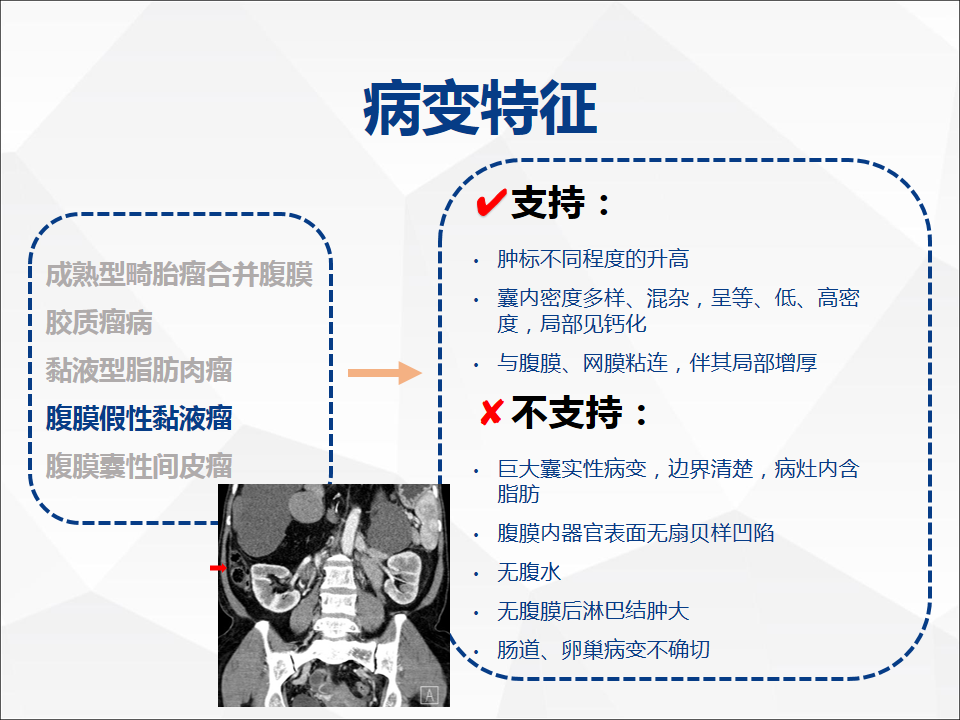 影像PPT - 【病例】腹腔成熟型畸胎瘤合并腹膜胶质瘤病1例CT-18