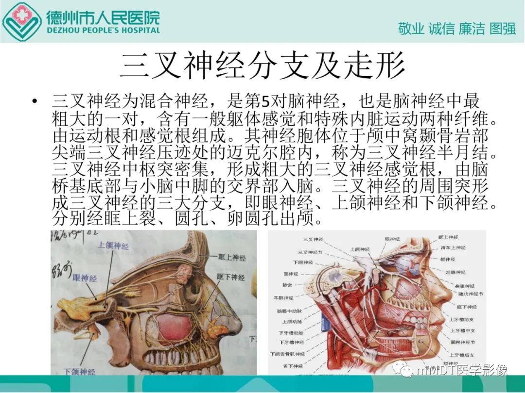 影像PPT - 【PPT】绕出崎岖孔孔道—三叉神经的颅底走形-3