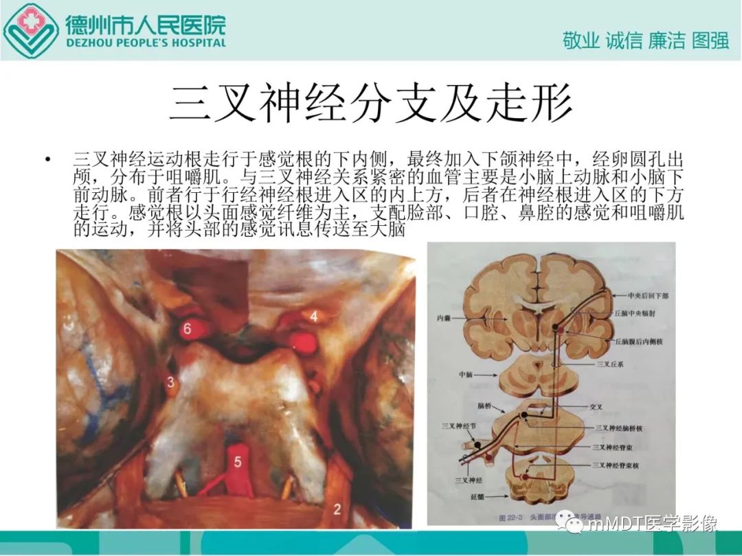影像PPT - 【PPT】绕出崎岖孔孔道—三叉神经的颅底走形-4