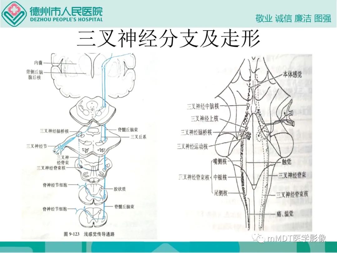 影像PPT - 【PPT】绕出崎岖孔孔道—三叉神经的颅底走形-7