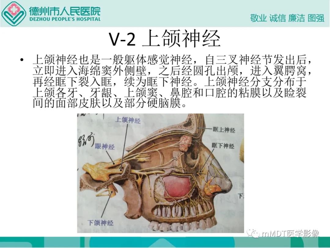 影像PPT - 【PPT】绕出崎岖孔孔道—三叉神经的颅底走形-14