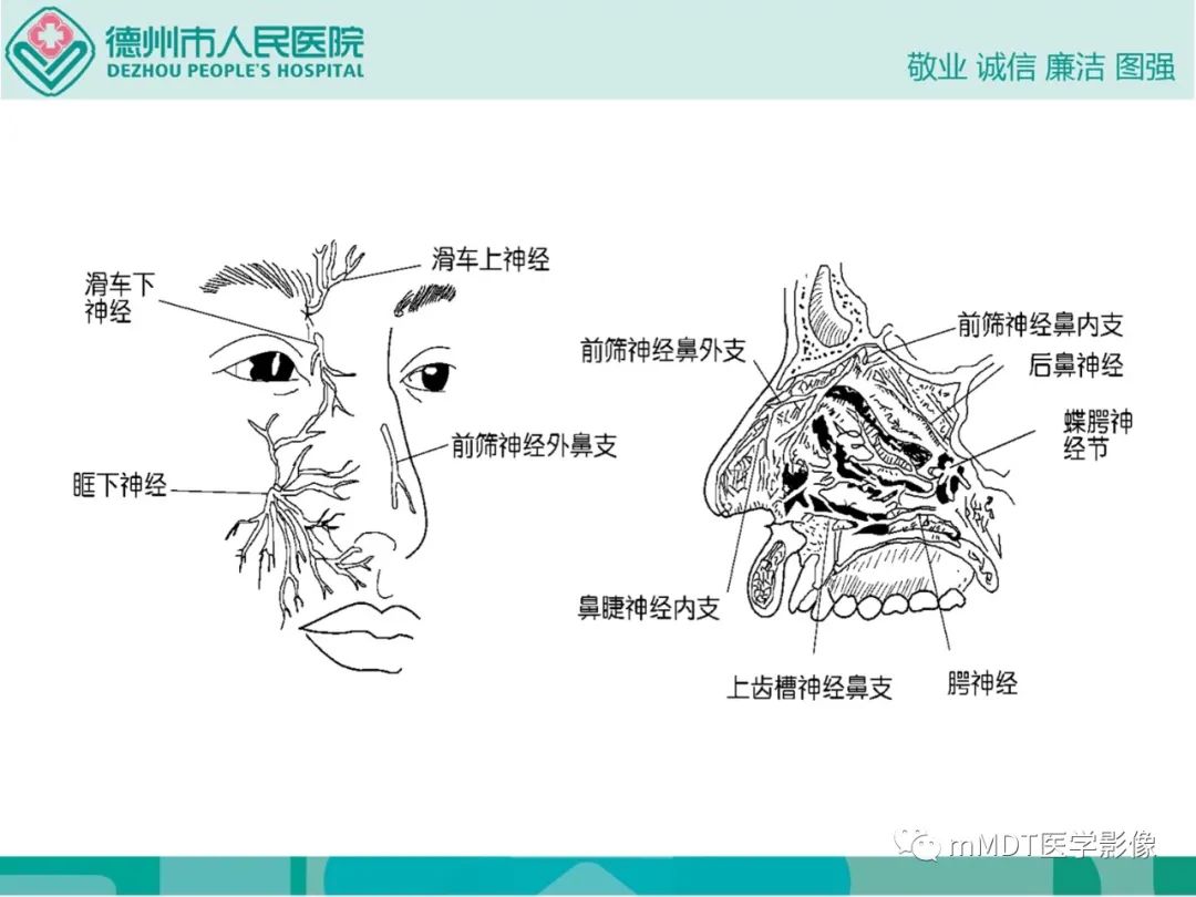 影像PPT - 【PPT】绕出崎岖孔孔道—三叉神经的颅底走形-13
