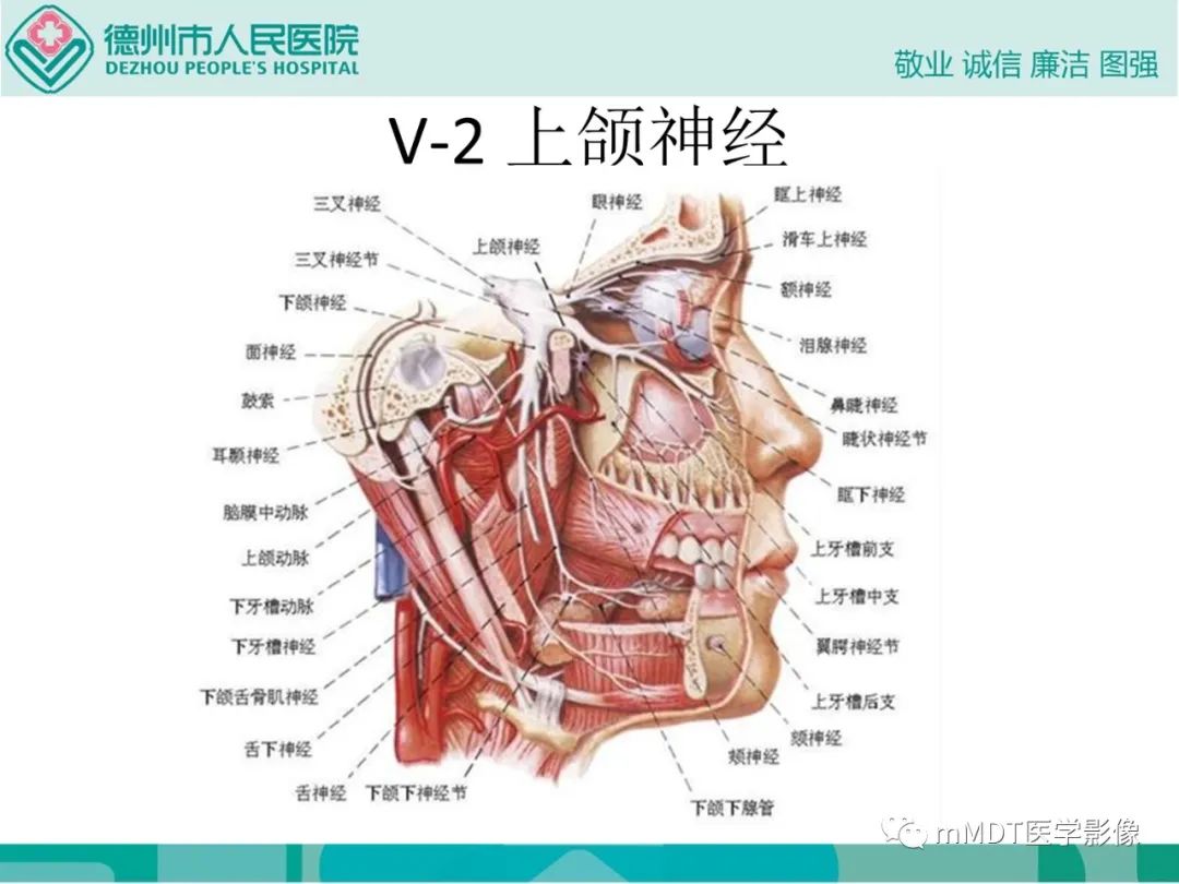 影像PPT - 【PPT】绕出崎岖孔孔道—三叉神经的颅底走形-19