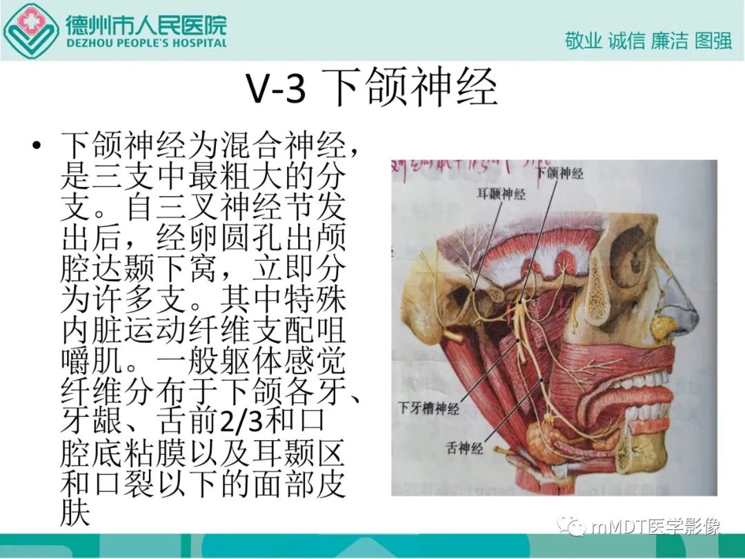 影像PPT - 【PPT】绕出崎岖孔孔道—三叉神经的颅底走形-20