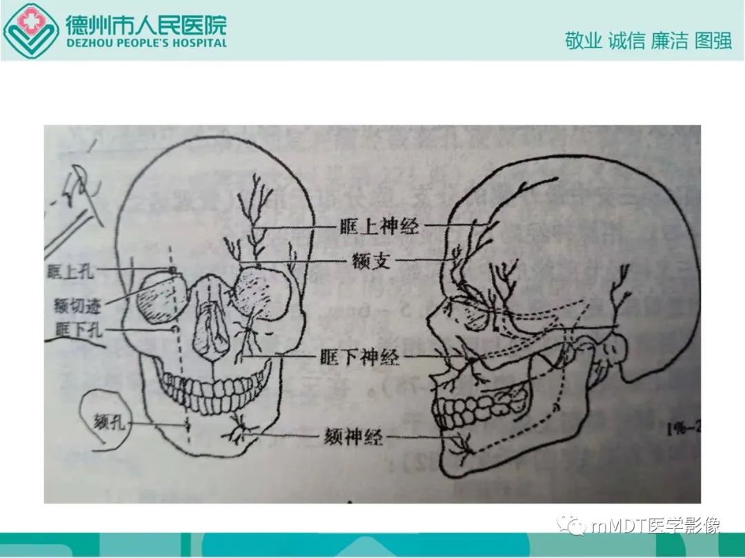 影像PPT - 【PPT】绕出崎岖孔孔道—三叉神经的颅底走形-24