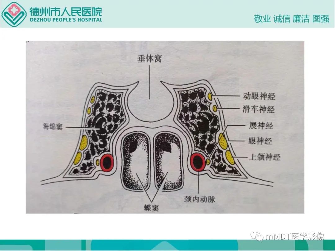 影像PPT - 【PPT】绕出崎岖孔孔道—三叉神经的颅底走形-26