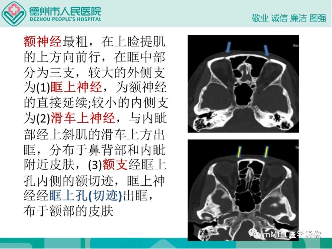 影像PPT - 【PPT】绕出崎岖孔孔道—三叉神经的颅底走形-48