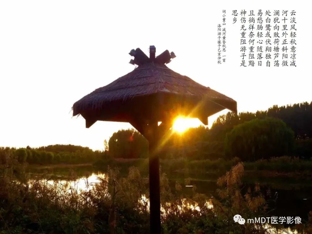 影像PPT - 【PPT】绕出崎岖孔孔道—三叉神经的颅底走形-58