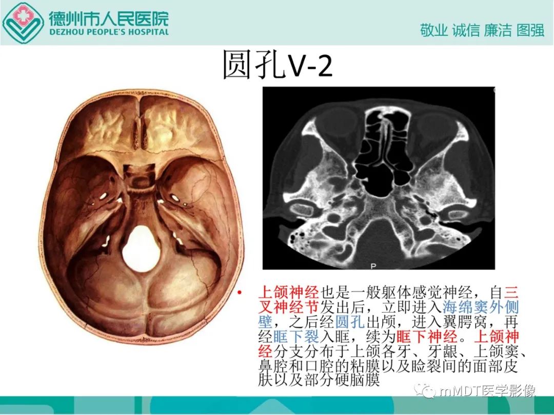 影像PPT - 【PPT】绕出崎岖孔孔道—三叉神经的颅底走形-59