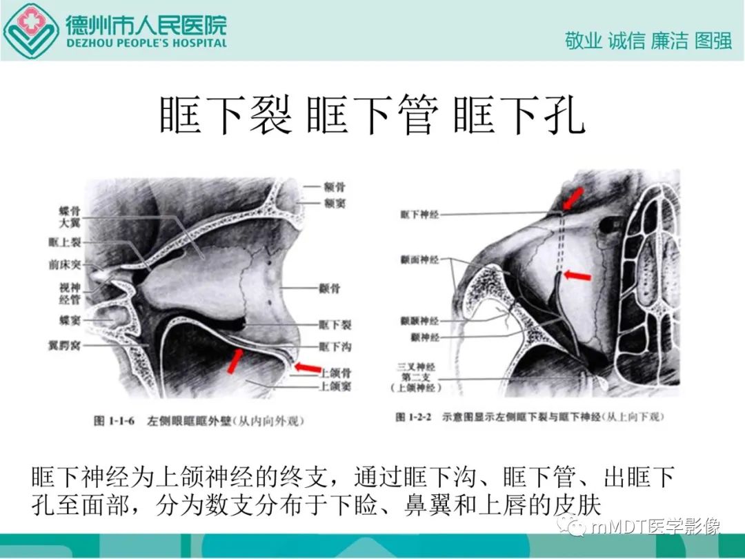 影像PPT - 【PPT】绕出崎岖孔孔道—三叉神经的颅底走形-65